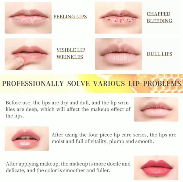 Milk Lip Treatment Kit