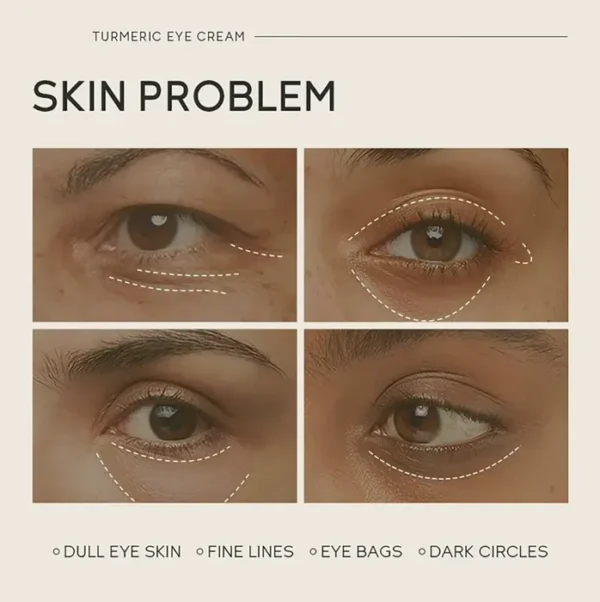 Turmeric Eye-area Serum
