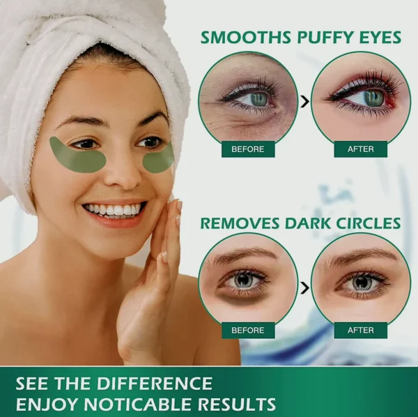 VANELC Under-Eye Patches for Youthful Look, Hydrating Solution